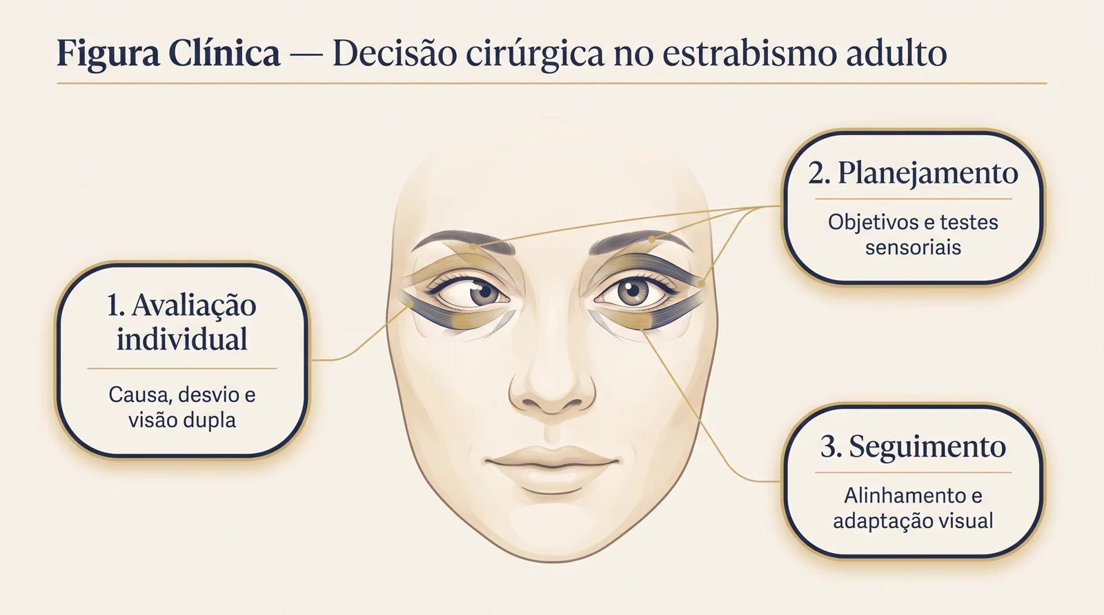 Figura clínica sobre decisão cirúrgica no estrabismo adulto, com rosto estilizado, músculos extraoculares e três etapas: avaliação individual, planejamento e seguimento.