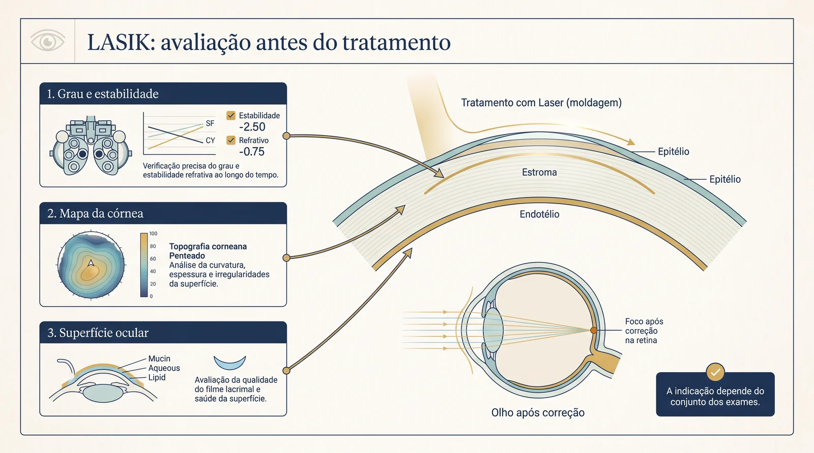 Prancha clínica sobre avaliação pré-operatória do LASIK, córnea, superfície ocular e foco na retina.