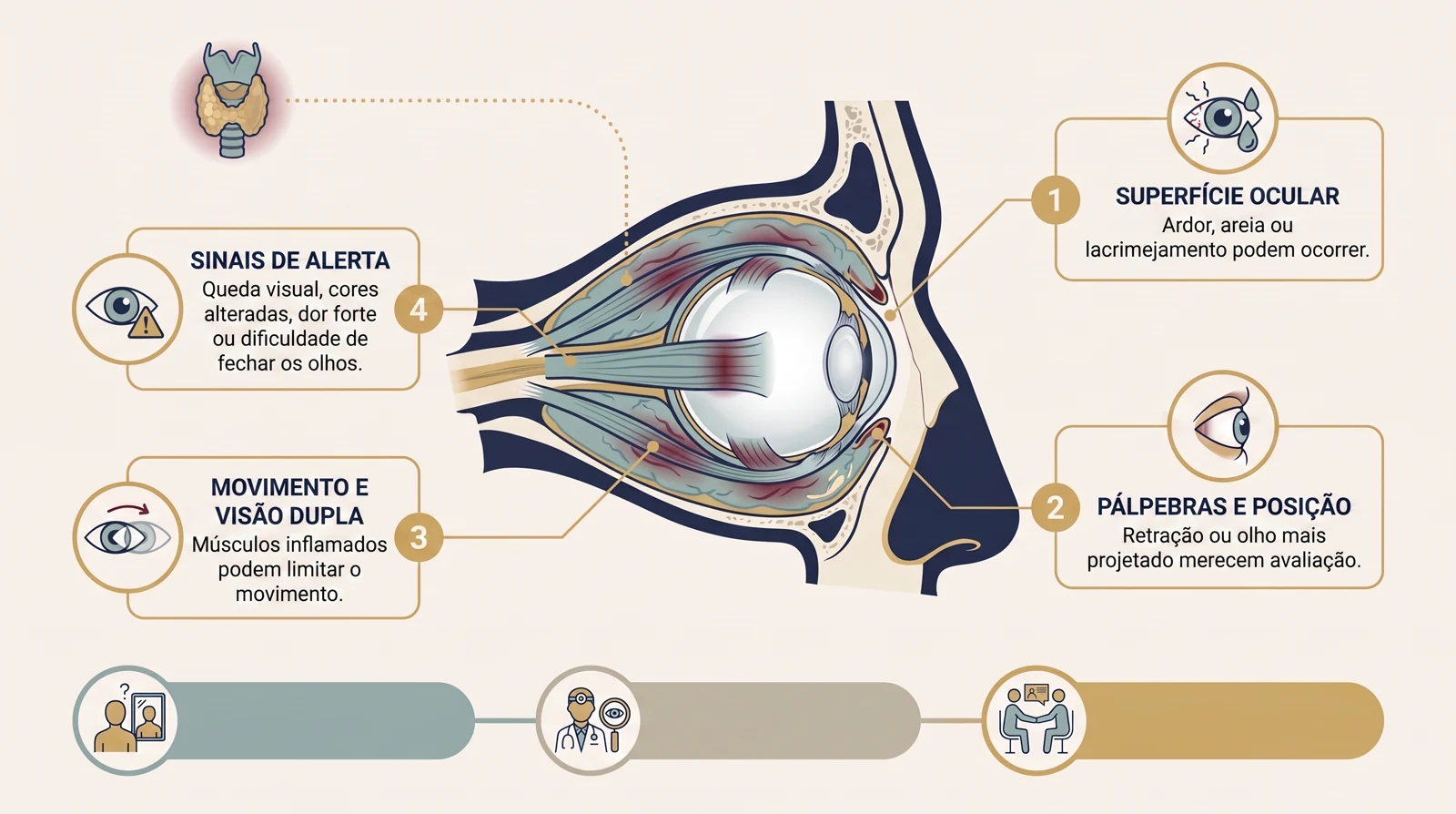 Prancha clínica em corte lateral da órbita com globo ocular, músculos extraoculares, nervo óptico, ligação com a tireoide e quatro caixas de avaliação da oftalmopatia de Graves.
