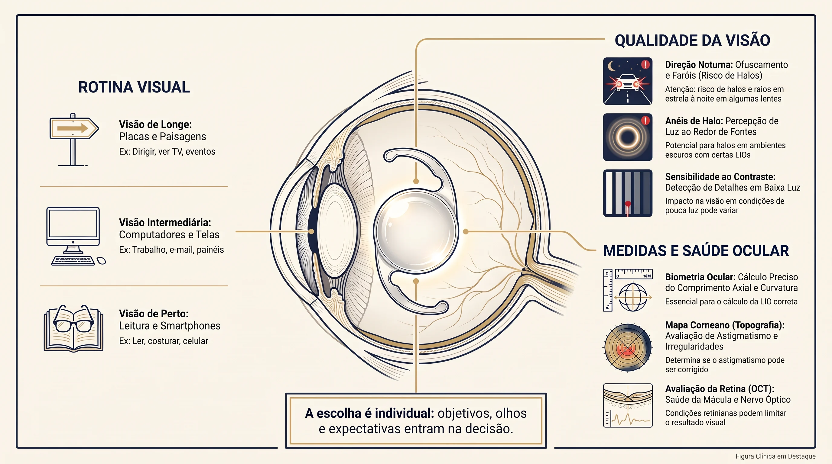 Ilustração editorial de um olho com lente intraocular e painéis sobre rotina visual, qualidade da visão e avaliação ocular