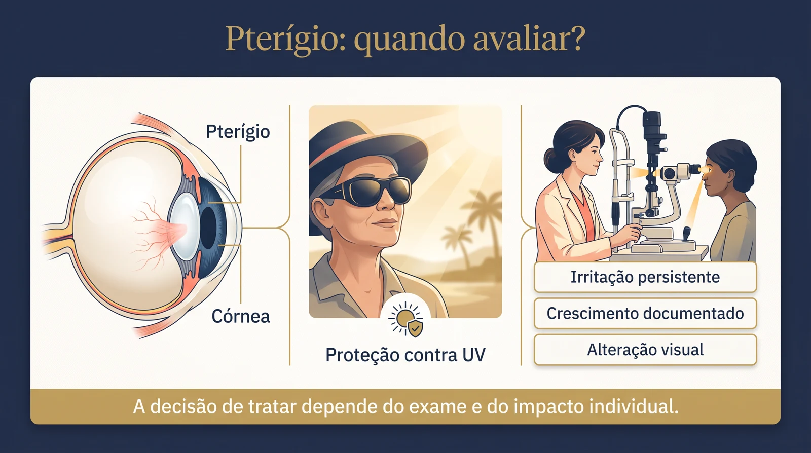 Ilustração clínica com anatomia do pterígio, proteção solar e avaliação na lâmpada de fenda