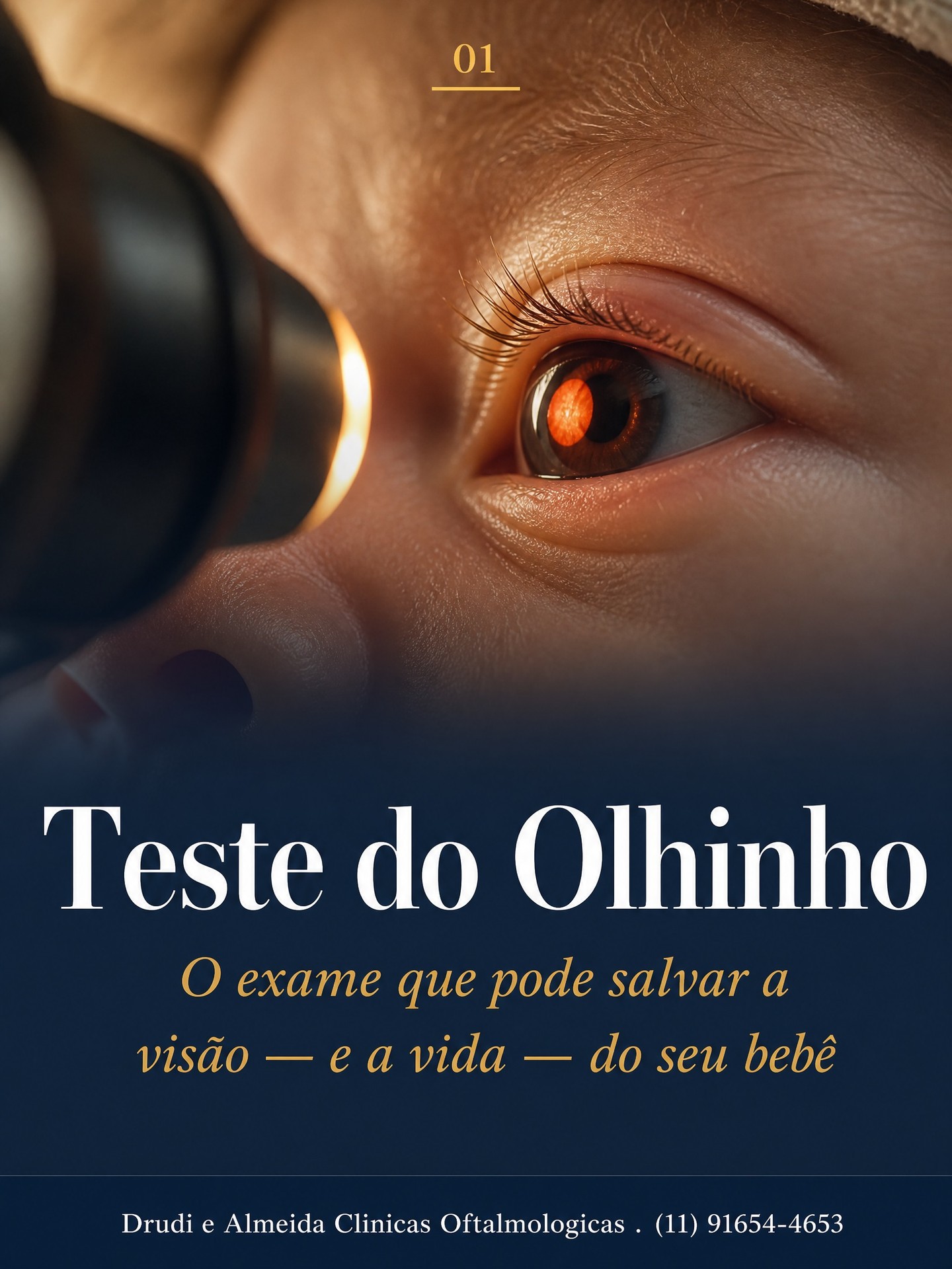 Carrossel: A pupila do seu bebê estava branca na foto com flash?

Isso pode ser leucocoria