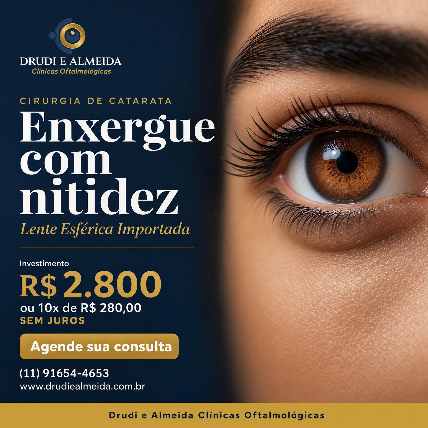 Vídeo: Sua visão merece o melhor. A catarata não precisa esperar.

A Cirurgia de Catara