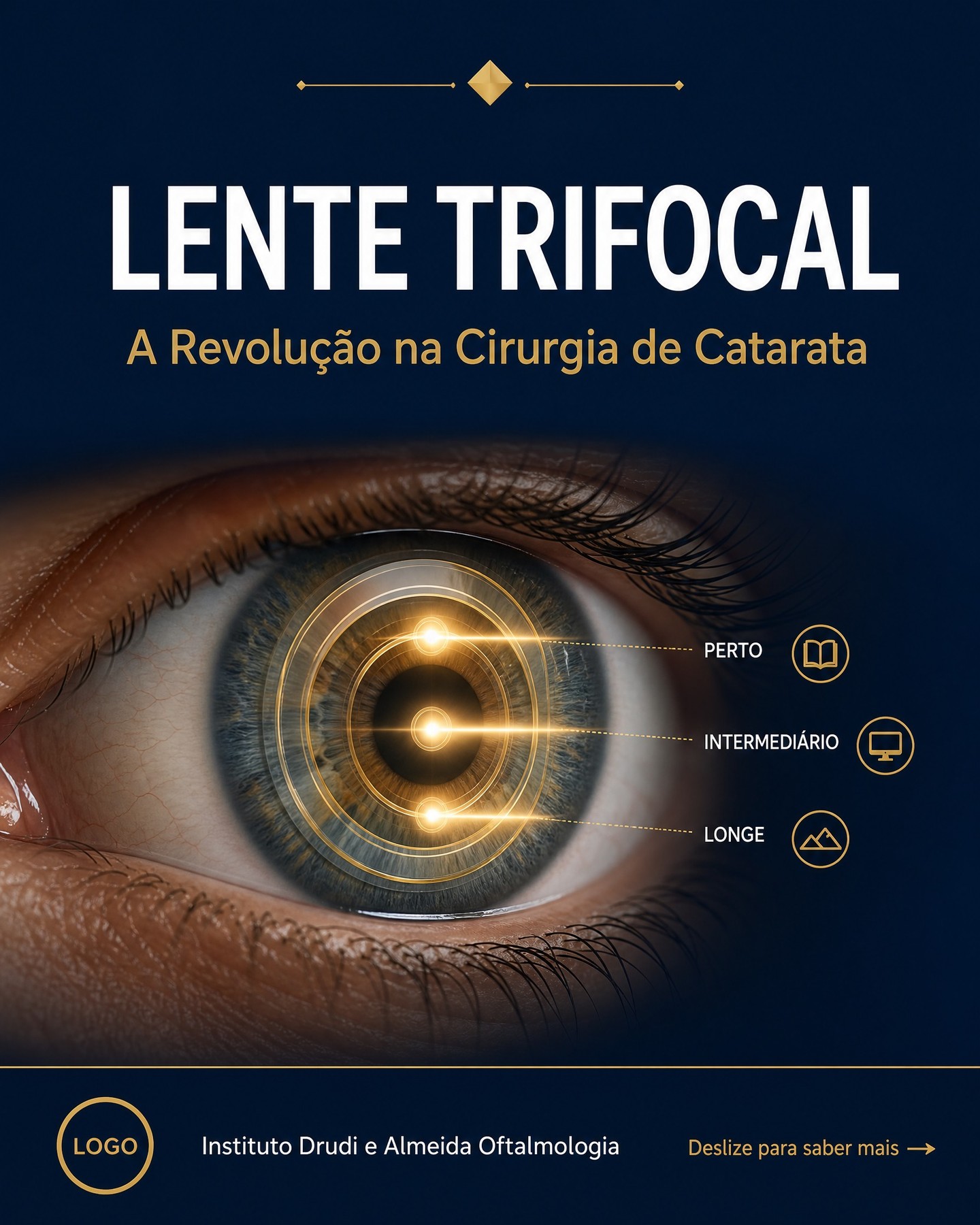 Carrossel: Você sabia que a cirurgia de catarata pode ser a oportunidade de nunca mais depe