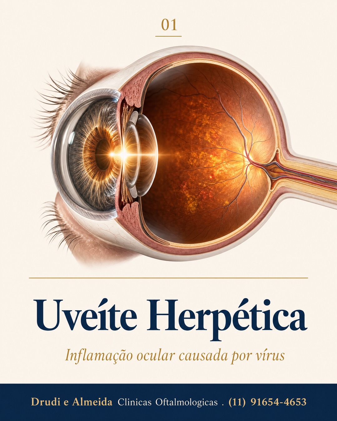 Carrossel: Você sabia que o mesmo vírus do herpes labial pode causar inflamação grave dentr