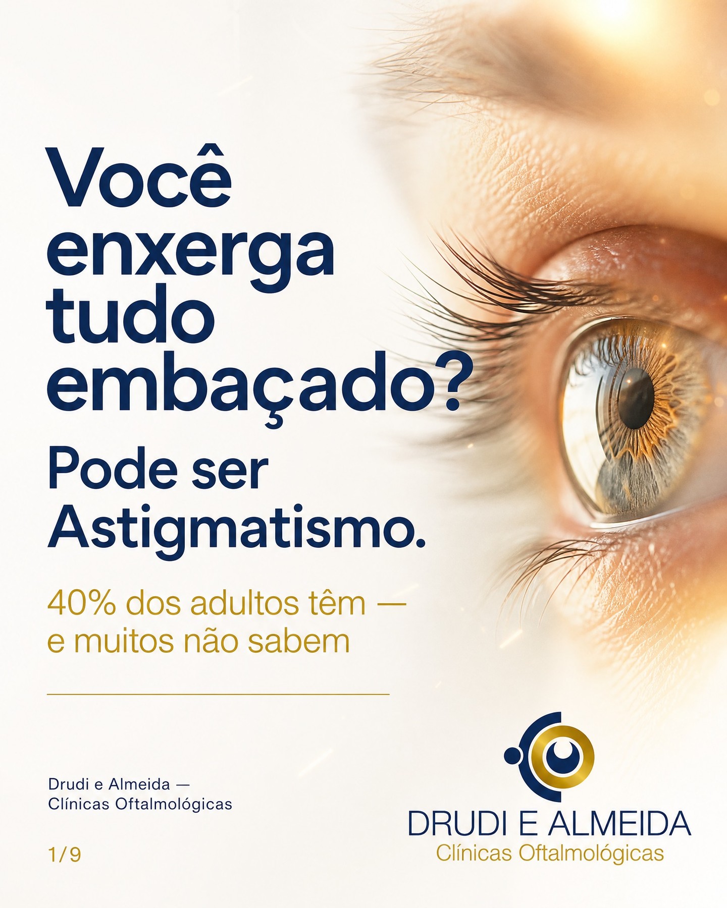 Vídeo: Você enxerga tudo embaçado? Pode ser Astigmatismo — e 40% dos adultos têm sem saber.