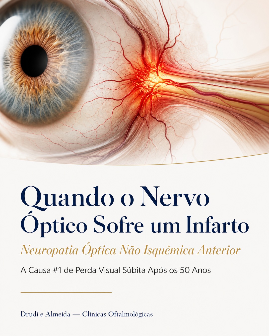 Carrossel: Você acordou e percebeu que metade da sua visão havia desaparecido. Sem dor. Sem