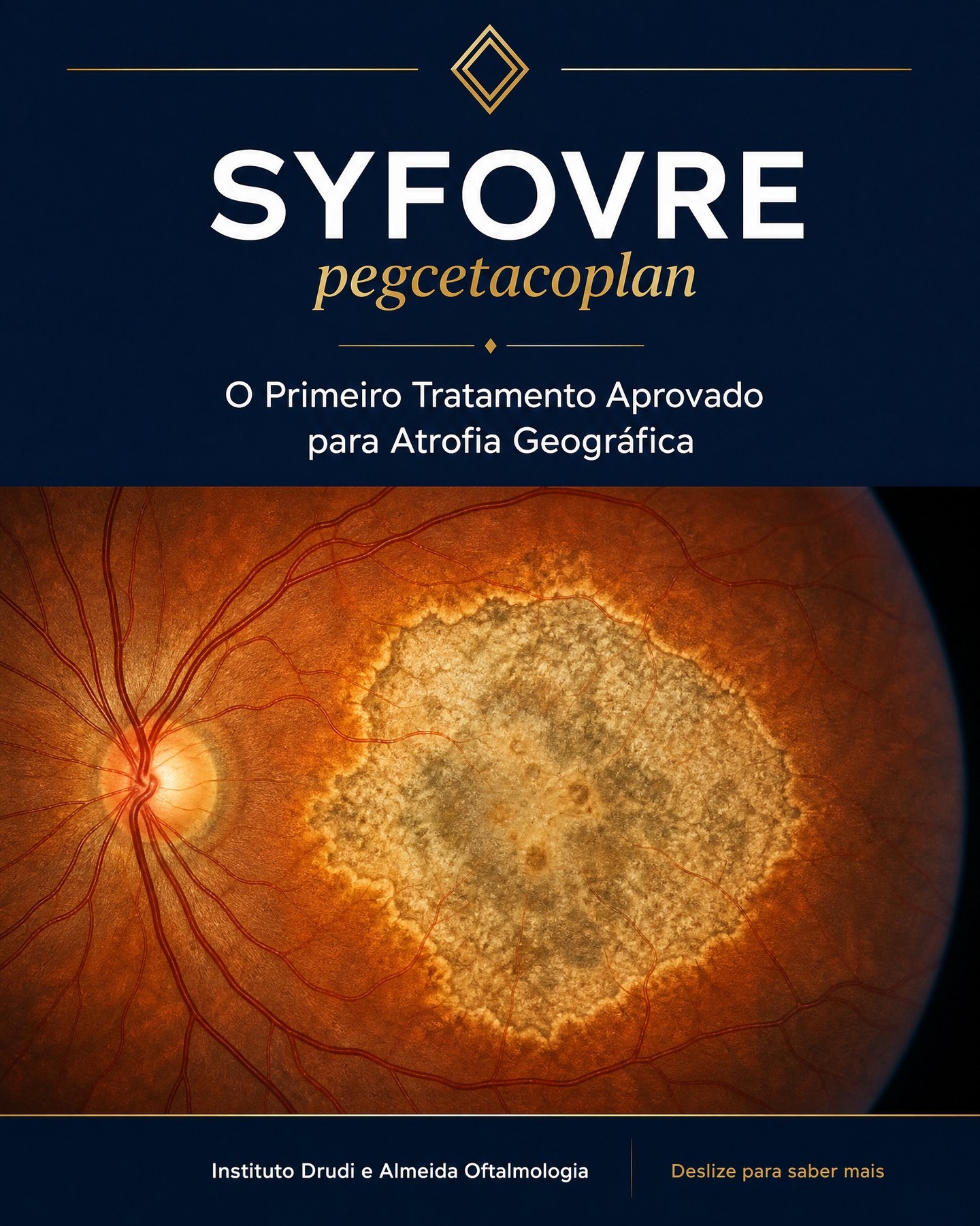 Carrossel: Durante décadas, o diagnóstico de Atrofia Geográfica significava uma sentença se